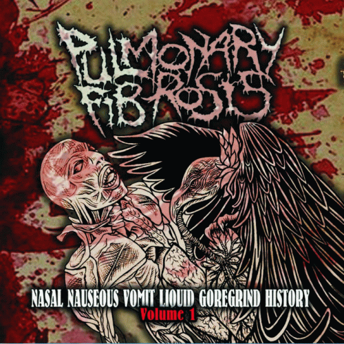 Pulmonary Fibrosis : Nasal Nauseous Vomit Liquid Goregrind History Volume 1